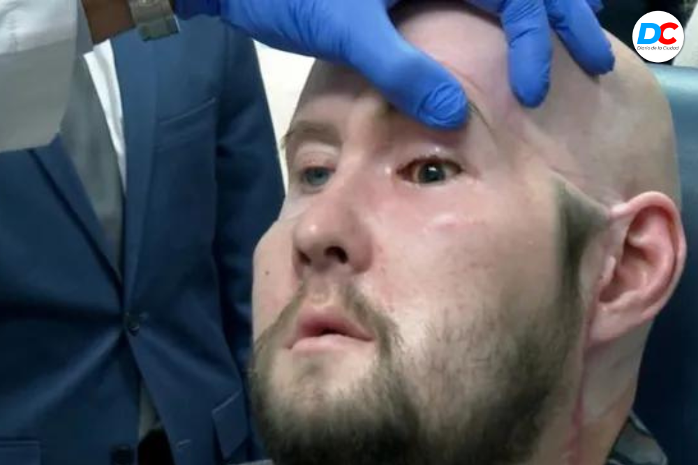 Un hombre recibió el primer trasplante de ojo completo en el mundo 1 Diseno sin titulo2 6